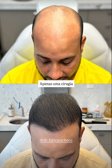apenas uma cirurgia